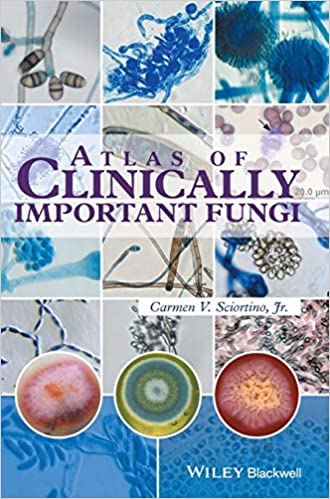 Atlas of Clinically Important Fungi (True PDF)