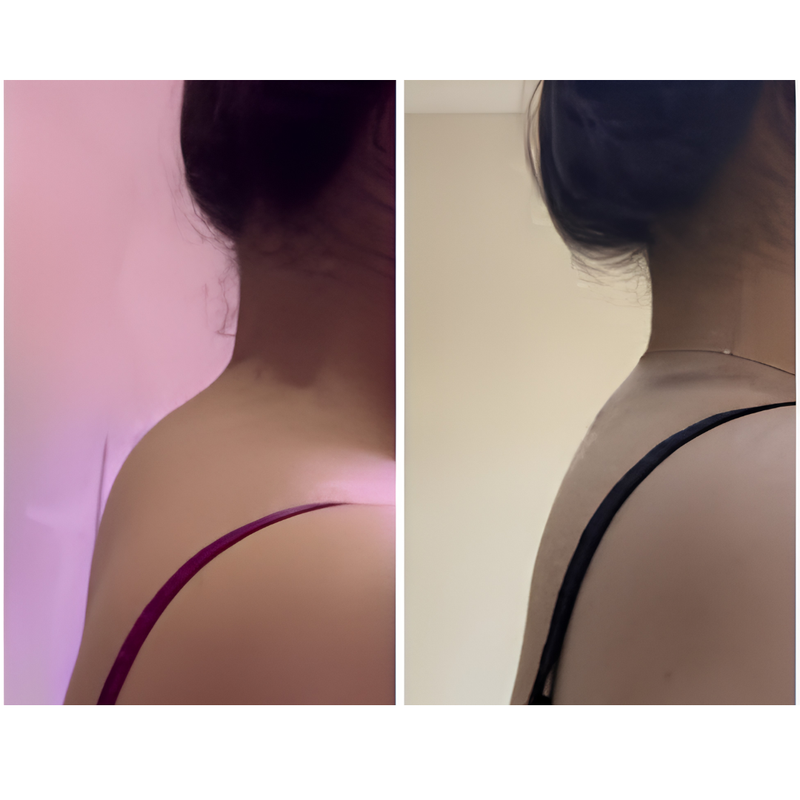 Avant / Après posture