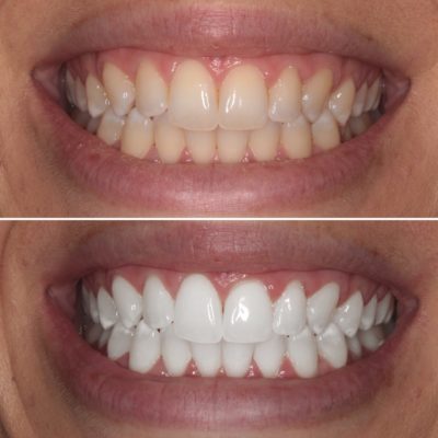 Cosmetic Dentistry