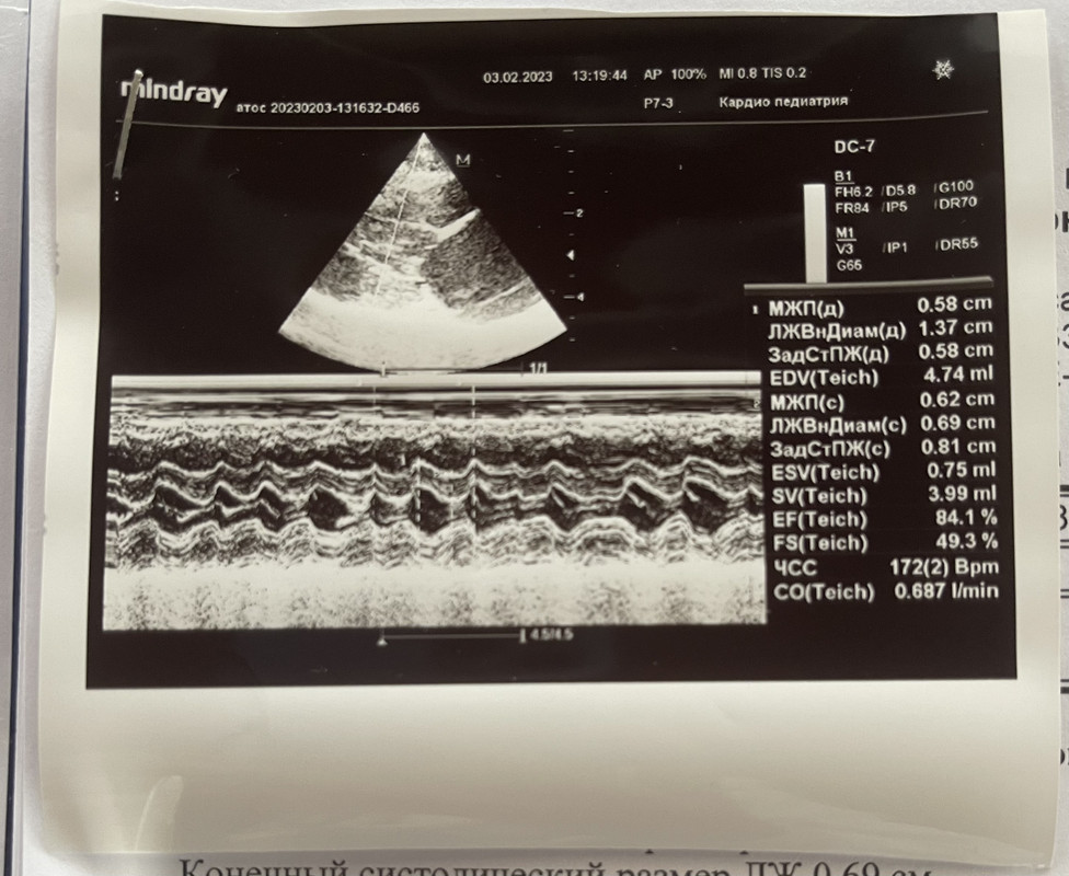 0BFE0327-E725-4695-920B-9951D32CE1EC