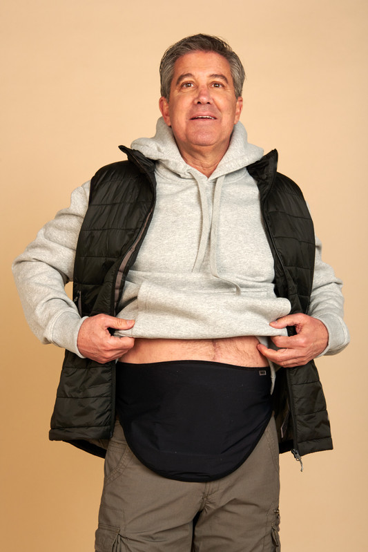 Crohn’s, Ulcerative Colitis, Diverticulitis and Ostomy Bags