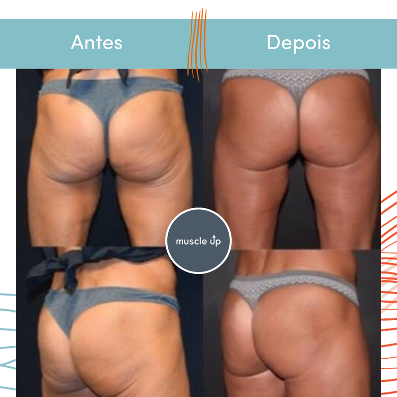 Projeto 2