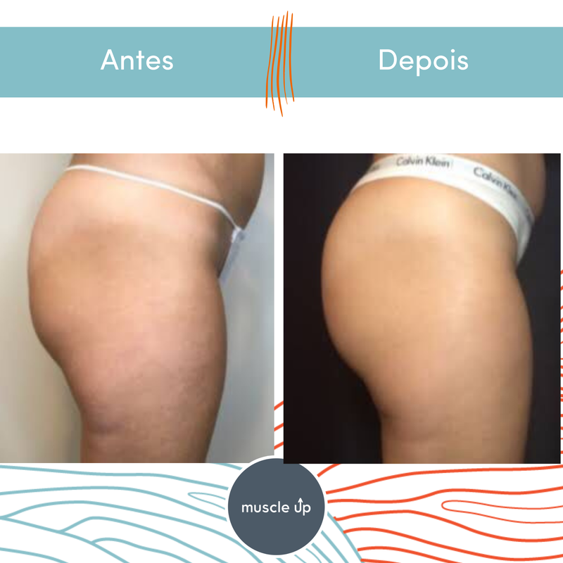 Projeto 4