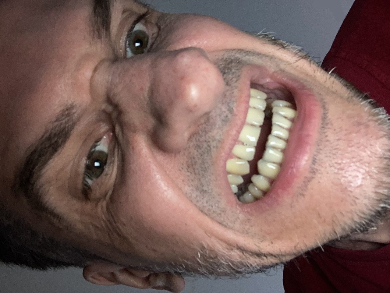 AWROE 15