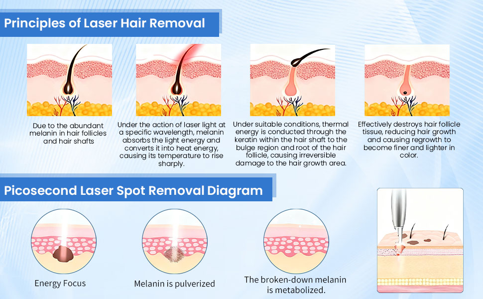Laser Hair Removal & Picosecond Principle