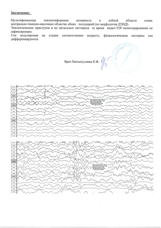 ЭЭгВоронцова2