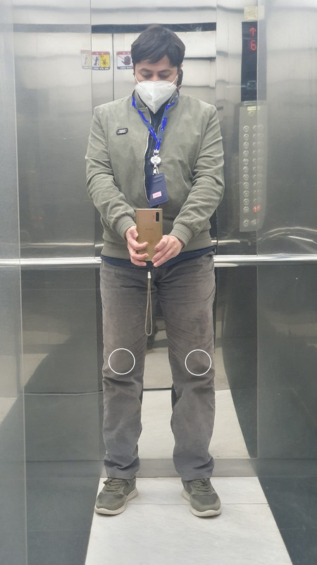 Do I look normal?