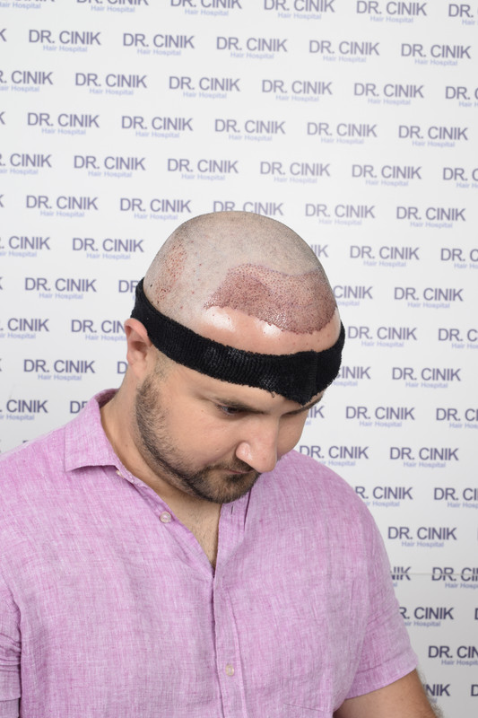 photos postopératoires (3)