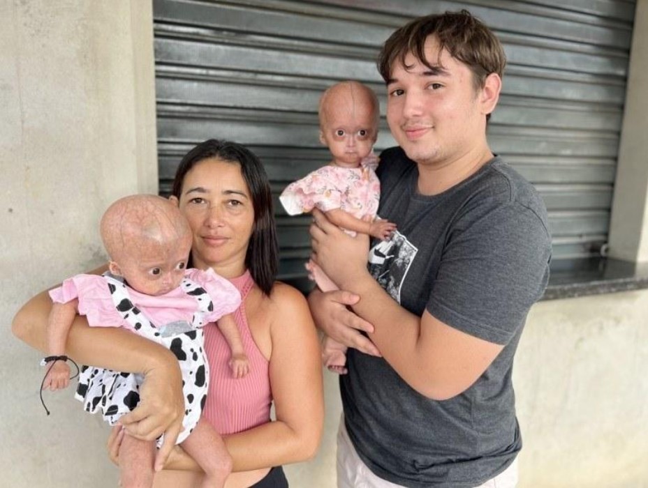 Eliz e Eloá vivem com a mãe, o irmão e a irmã adolescente na zona Oeste de Boa Vista – Foto: Caíque Rodrigues/g1 RR