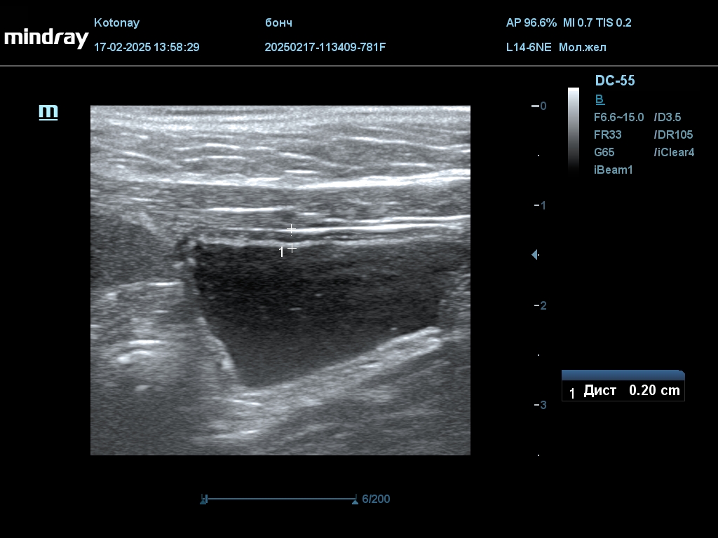 202502171631310625CARD.JPG: мп и почки