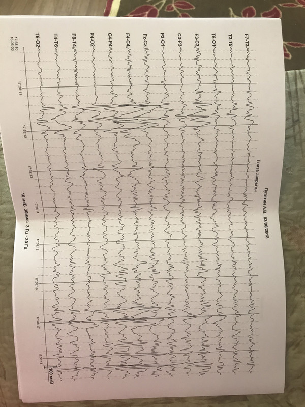 FDF0A4F7-2122-4B3A-AE64-55D0268636F0