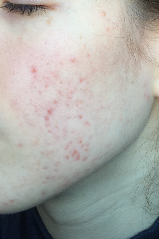 C2F80A26-DD33-40B2-9535-4969205F0BCF