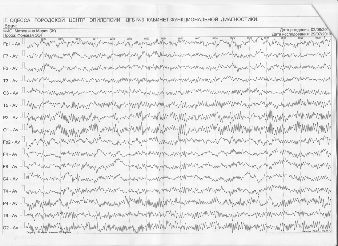 ЭЭГ дневн 29,07,19 -03