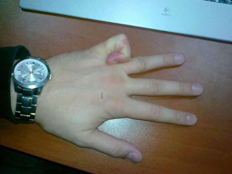 20 фото людей с самыми странными и бесполезными талантами