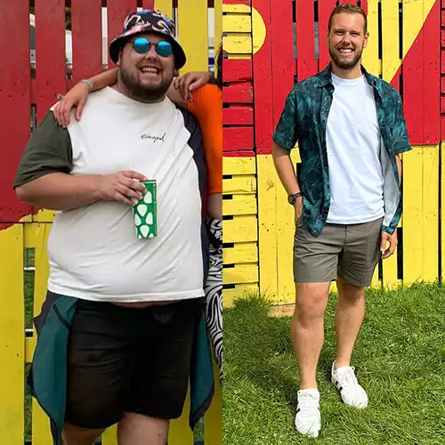 Xander White before and after