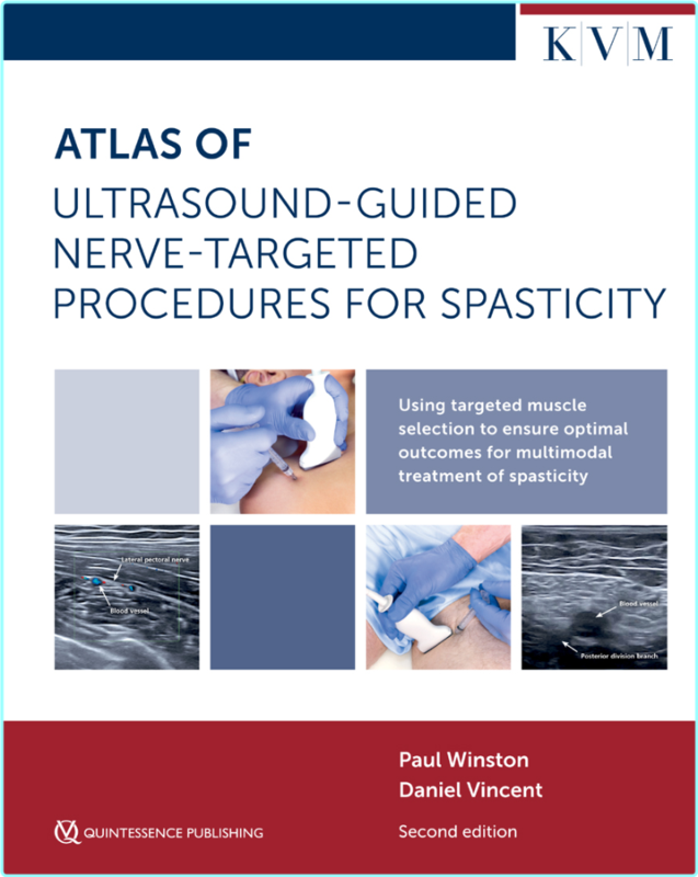 Atlas Of Ultrasound Guided Nerve Targeted Procedures For Spasticity Maximizing Outcomes For The Patient With Spasticity (Paul Winston;Daniel Vincen… Atlas Of Ultrasound Guided Nerve Targeted Procedures For Spasticity Maximizing Outcomes For The Patient With Spasticity (Paul Winston;Daniel Vincen…