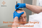 hair transplant ahmedabad