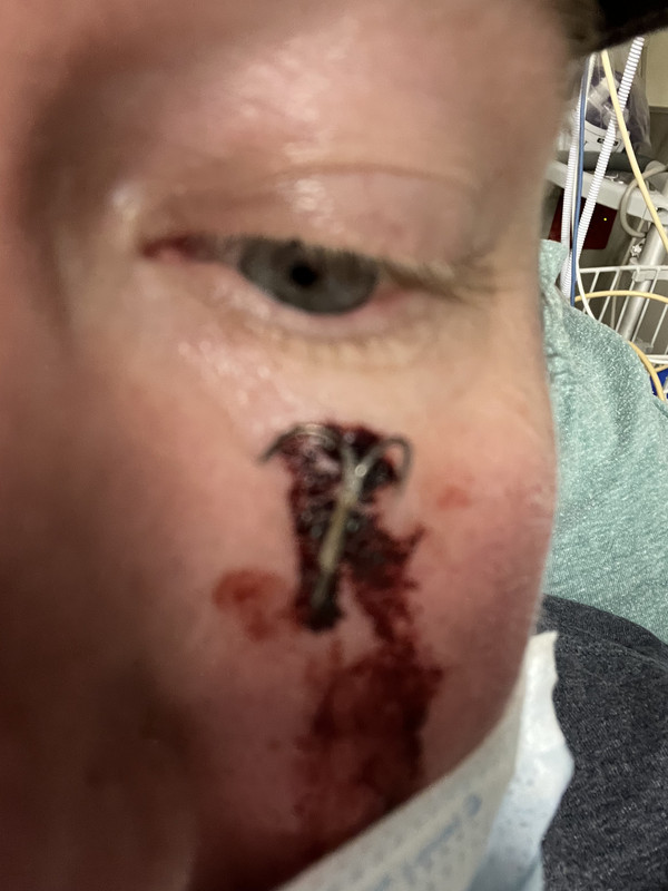 561D29FC-48ED-41E9-A49A-6858EE736D53