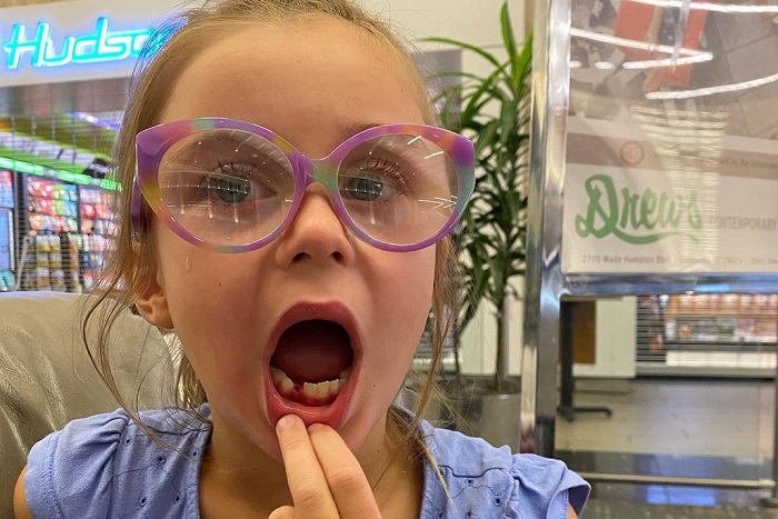 Lena, yang berusia 6 tahun, kehilangan gigi saat sedang perjalanan pulang dari New York bersama keluarganya pada 17 Juni 2022 lalu.