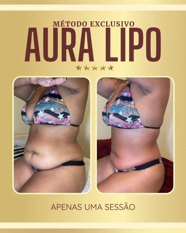 Resultados Aura Lipo - antes e depois