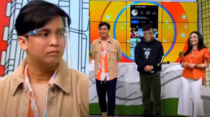 Mata Billy Syahputra disebut Uya Kuya dan Iis Dahlia bengkak