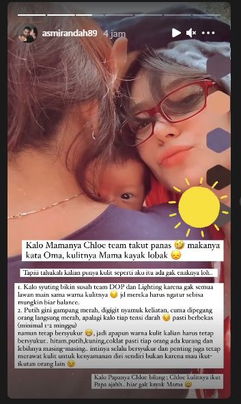 Asmirandah ceritakan suka duka memiliki kulit putih mulus