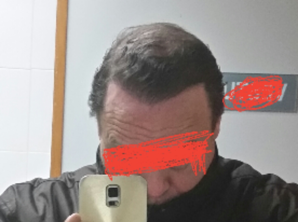 2018-03-01 06.49.35