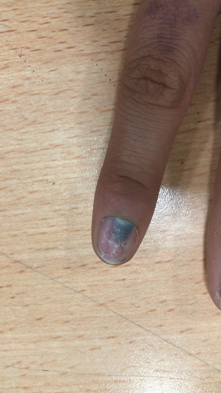 2956C2D0-53D5-4DDC-A2BD-D07B4447F3CA