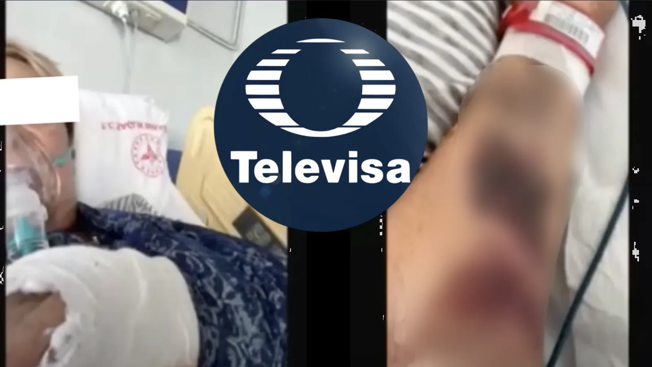 Actriz de Televisa sufre accidente, filtran fotos con tanque de oxígeno y moretones