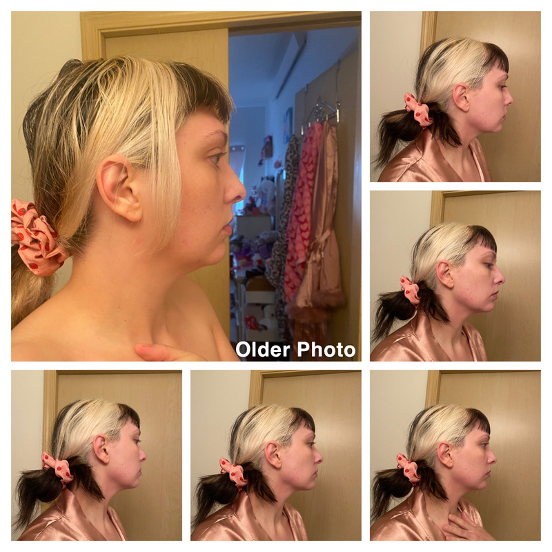 81AA04D9-6BDC-4FDD-BA64-2F7572E79CE2-COLLAGE