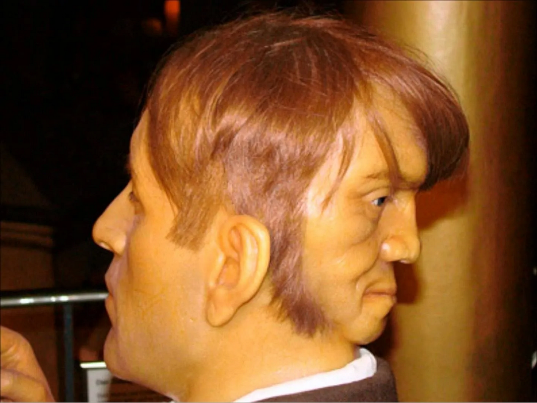 Edward Mordrake: la perturbadora historia del hombre con dos caras