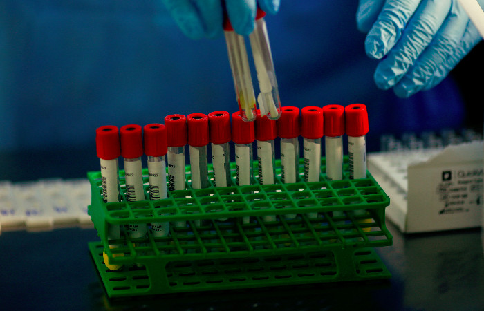 Oxford busca personas sanas que quieran contagiarse voluntariamente de COVID-19