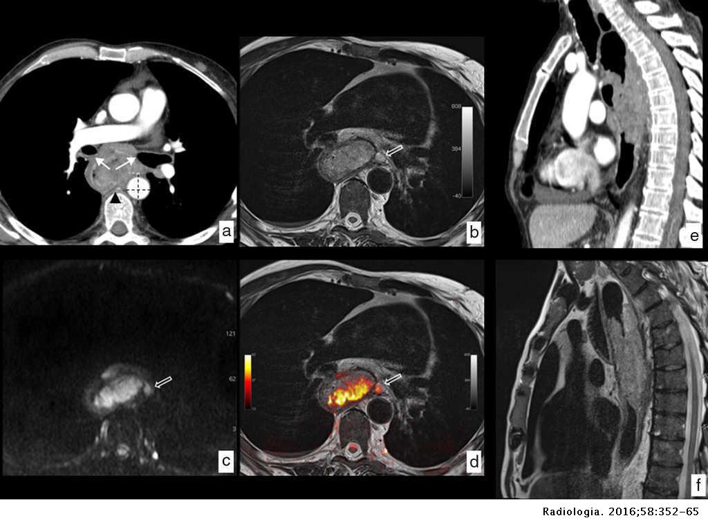 Muere médico que intentó salvar a su hija del cáncer; él también lo padecía