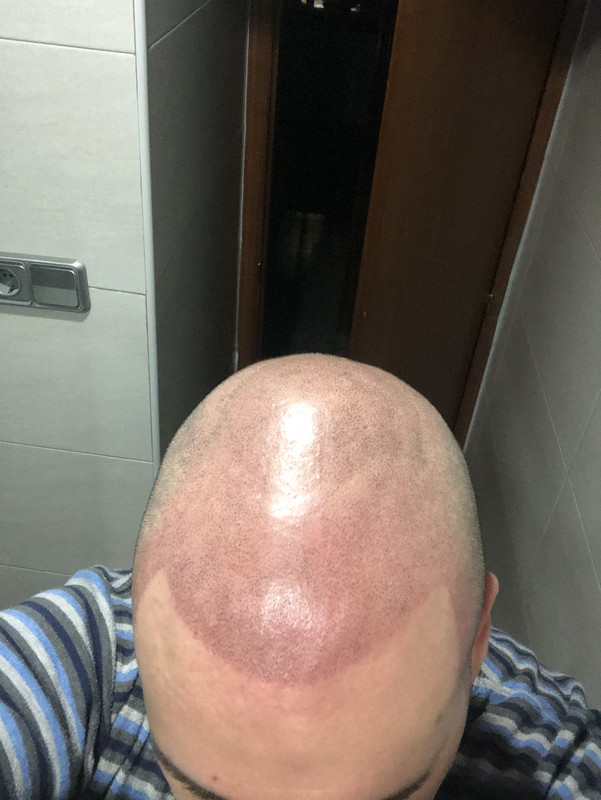 A33AC1BC-8D50-4C32-9C5F-33EBBB976F28