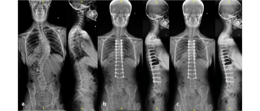 Injection gone wrong