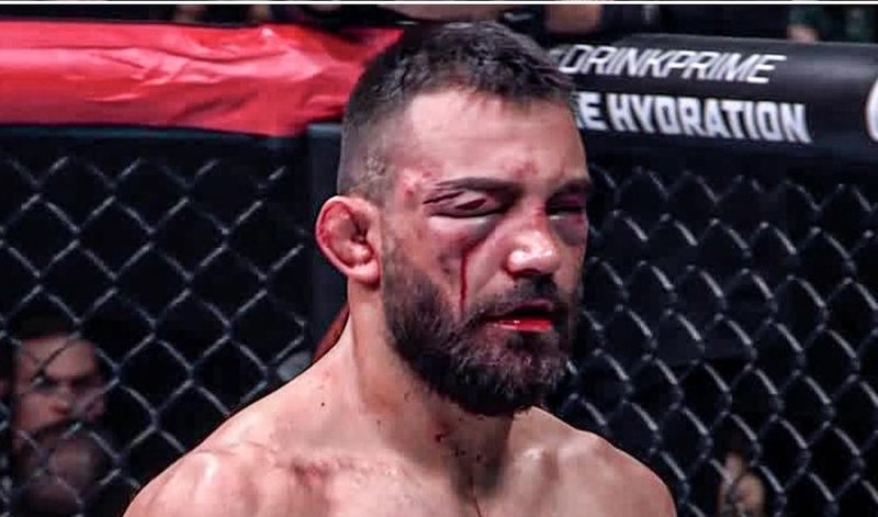 Ренато Мойкано обезобрази Беноа Сен Дени и победи с нокаут