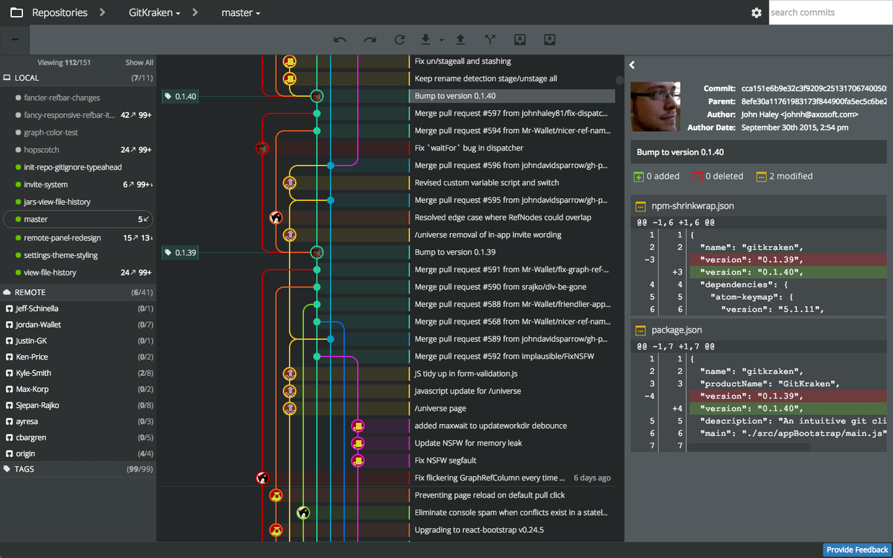 Git branch diagram