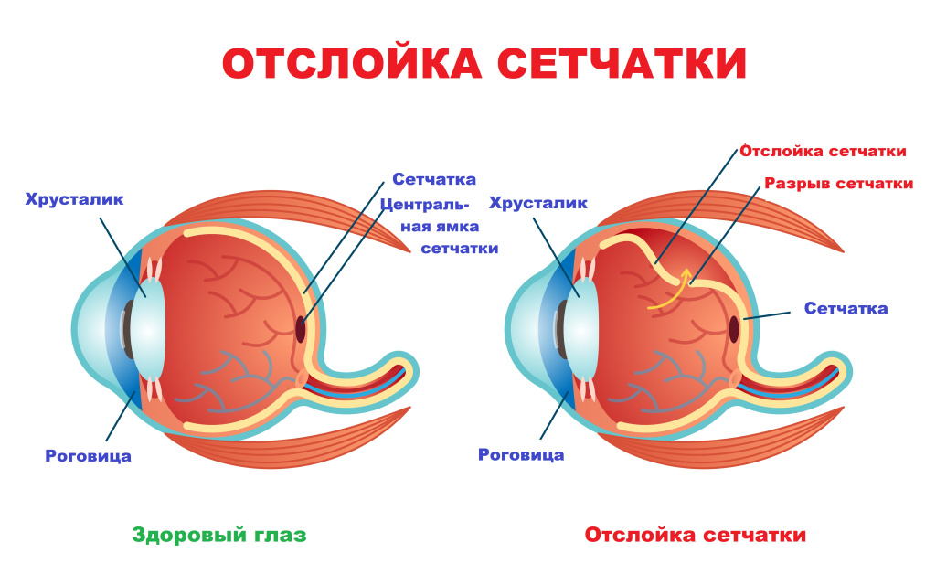 uu0omk6l5ujylzvgdhau2eerru2sue2q.jpg