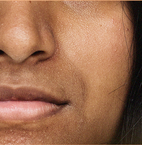 Dullness & Uneven Tone