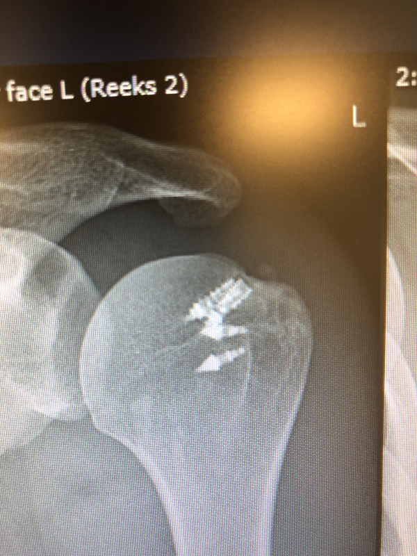 223A8F07-E914-42BB-BAC1-7EB8646DE431