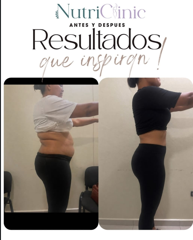Resultado antes y después 10
