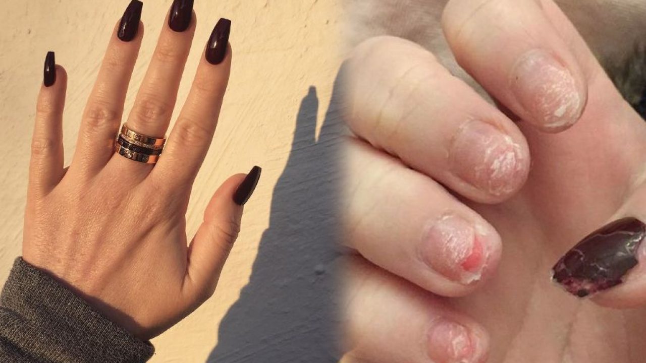 Influencer se vuelve viral por arrancarse las uñas en vivo