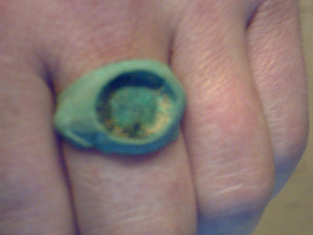 roman ring 001