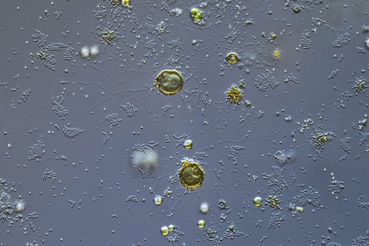 Microgromia 05 sp Filose Amöbe DIK 50-Z7