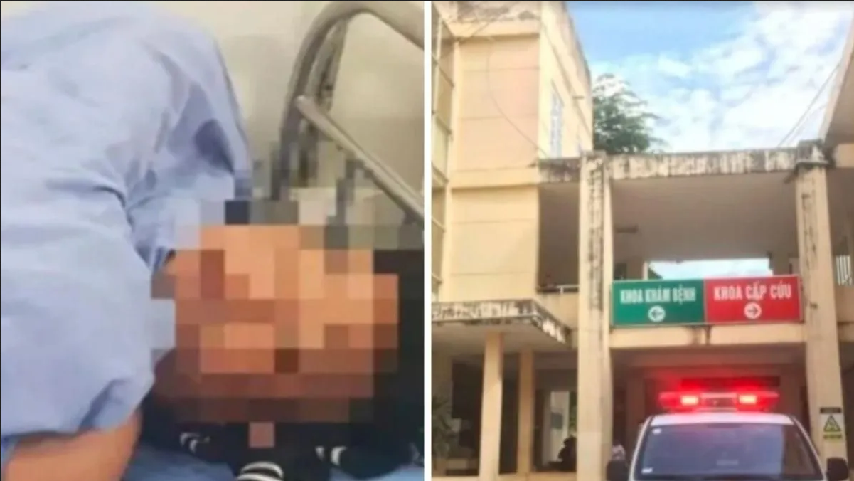 Por celos, mujer le corta el miembro a su esposo antes de San Valentín