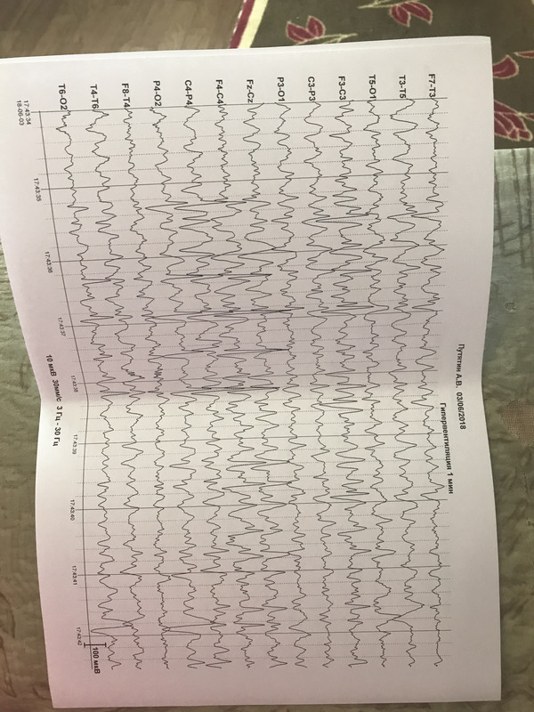 3CF68971-87A8-47C9-A9DE-635EBF213779