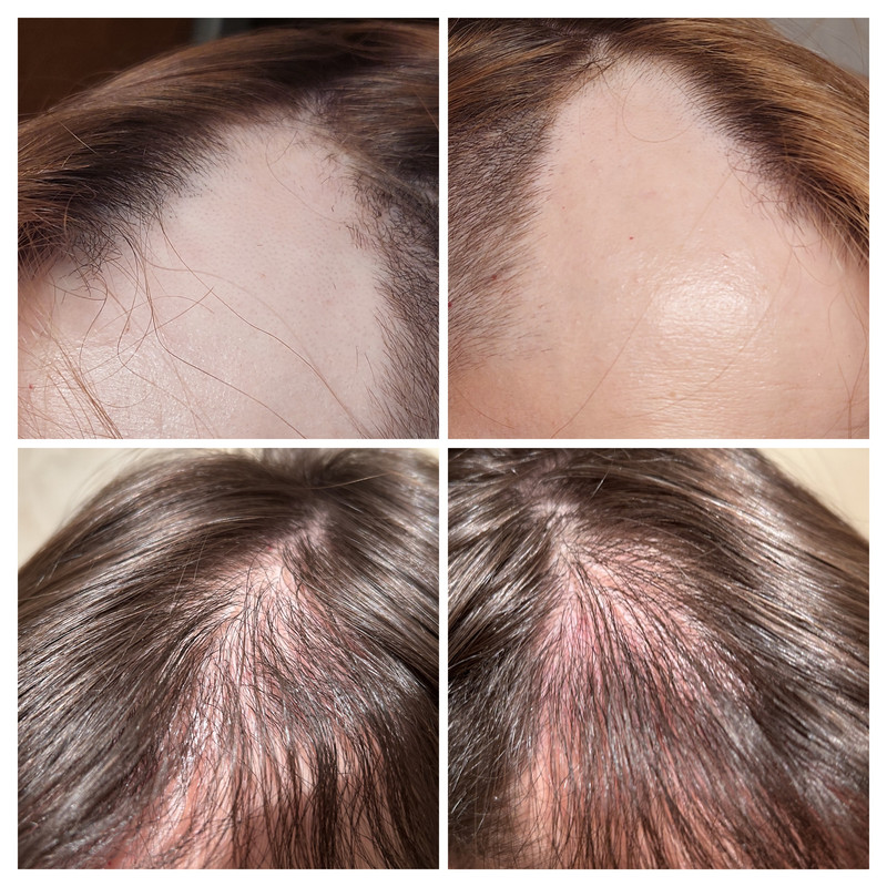 CA766409-2127-4052-B8A5-B54401197E40-COLLAGE