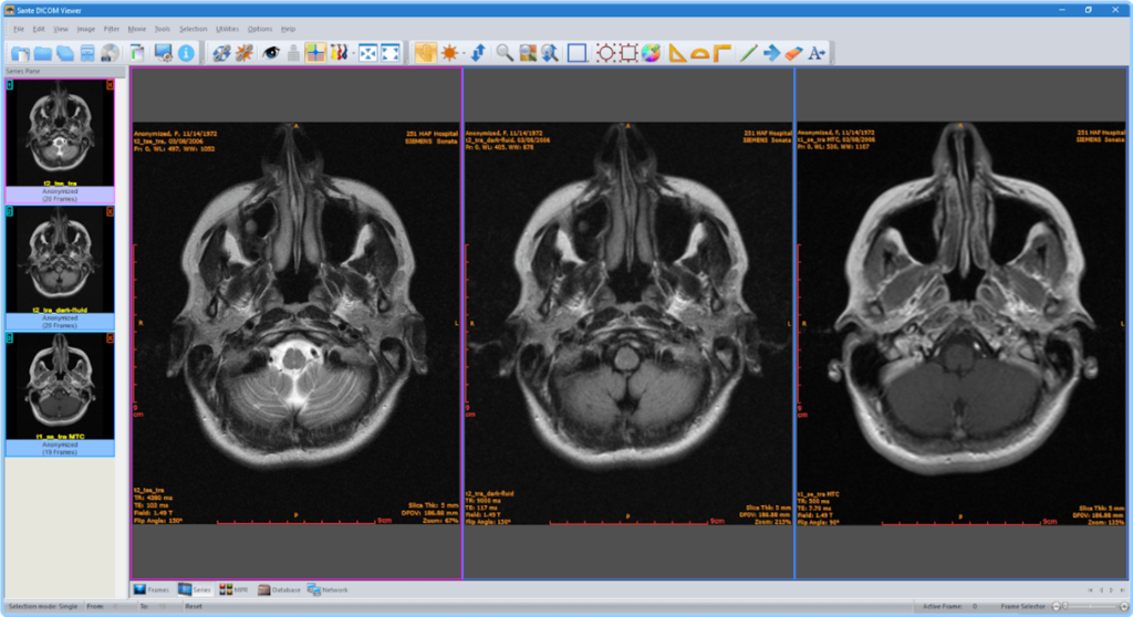 Sante DICOM Viewer Pro 14.0.10 Set15umdd3u4