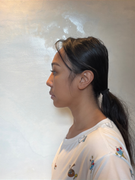 Right-Side-Profile-20028