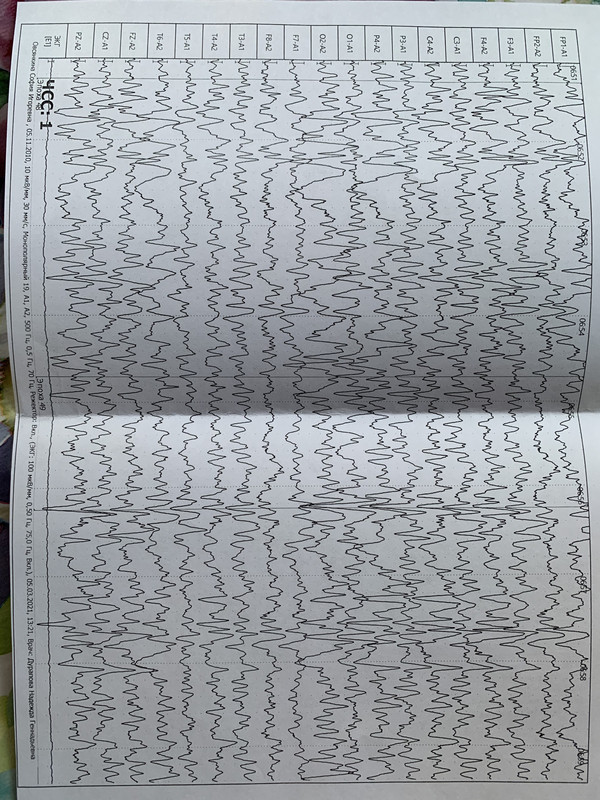 B02FBA4C-5C6A-439D-BD83-74A2D1BD3725